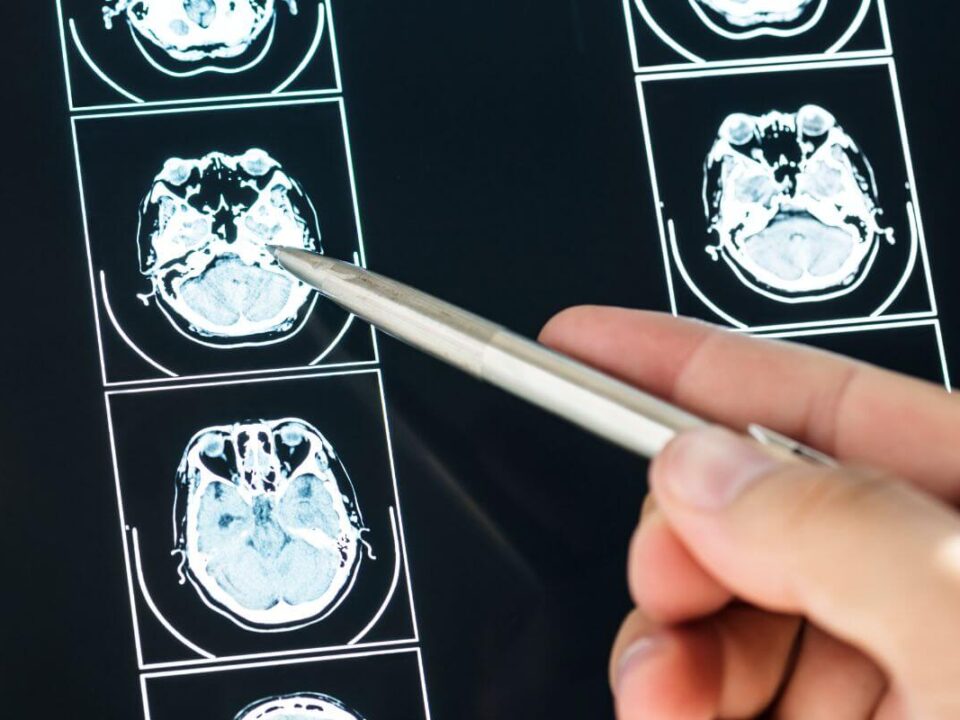 Sella MR vizsgálat Budapest