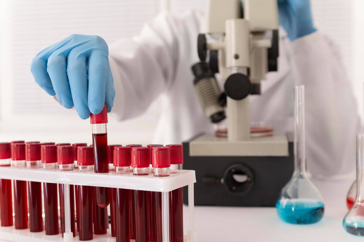 Autoimmun betegségek diagnosztizálása ENA 7 panel laborvizsgálattal.