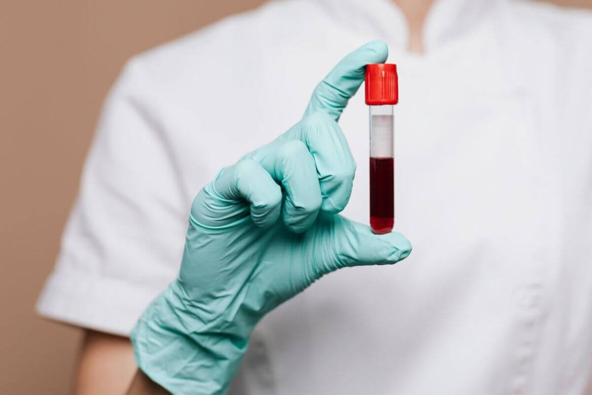 Alacsony ferritin érték.