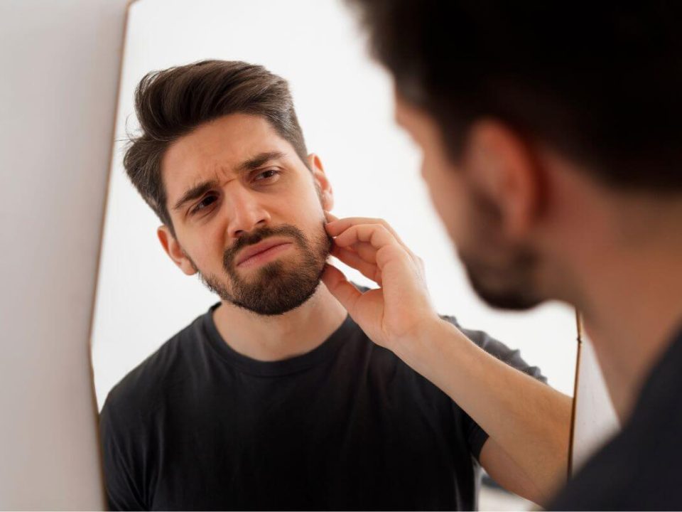 A foltos szakáll, más néven alopecia barbae, sok férfinak okoz esztétikai és lelki problémát.