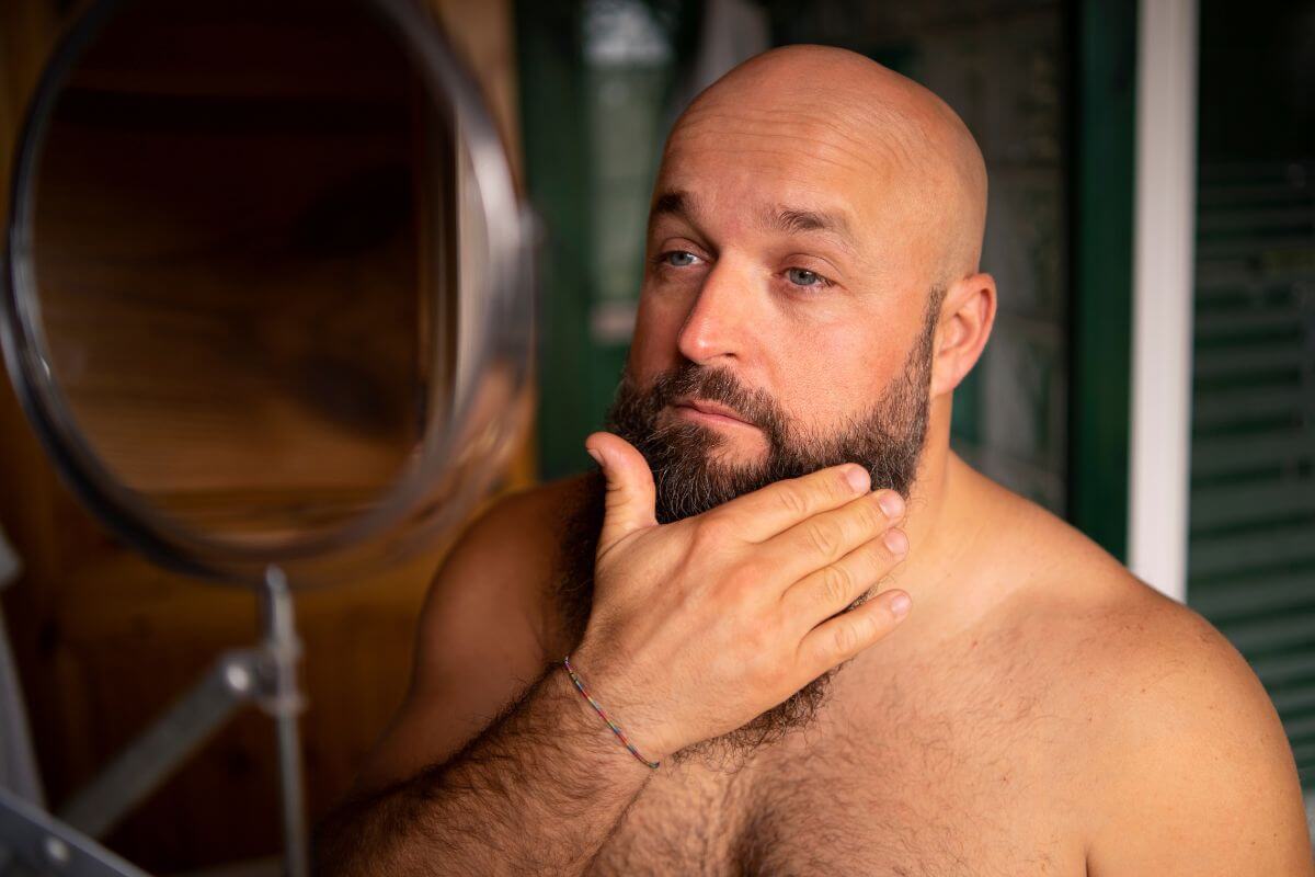 A foltos szakáll sok férfit érint, és gyakran genetikai, hormonális vagy életmódbeli okokra vezethető vissza